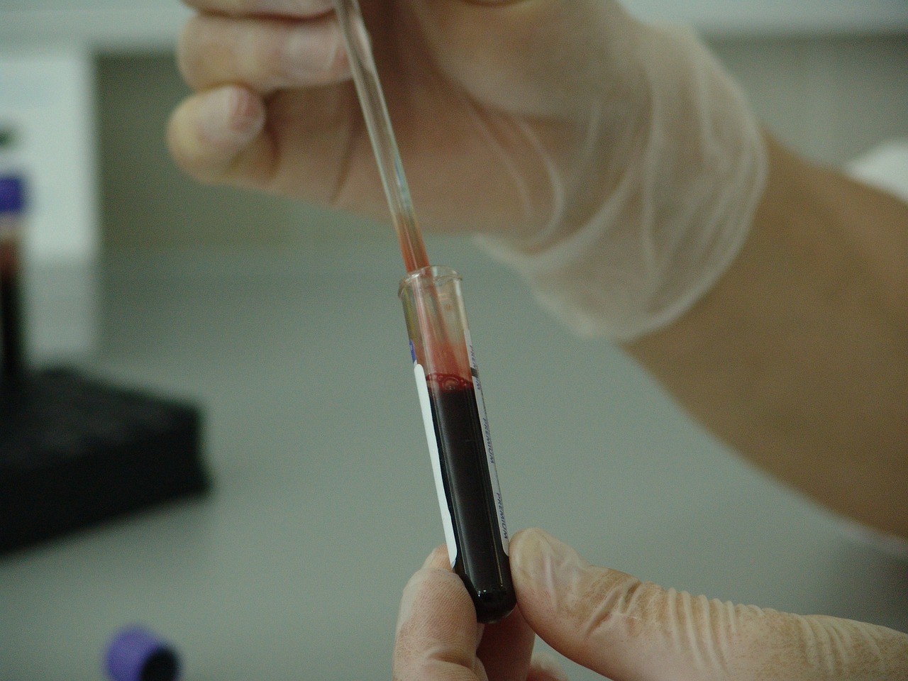 The Latest Findings on Genetic Factors in Disease